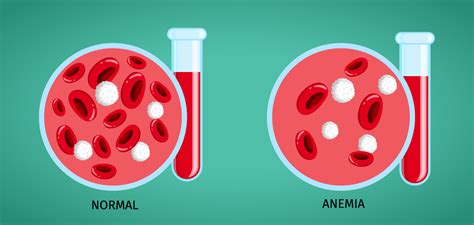 Anaemia